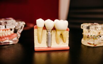 Repair and Enhance Your Smile with Dental Implants