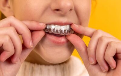 Lakewood Dentists Compare Invisalign® with Other Clear Aligners